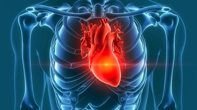 angina.jpg